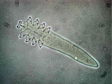 Микроскопический вид клеща Demodex folliculorum, способного вызывать демодекоз кожи и воспаление век.