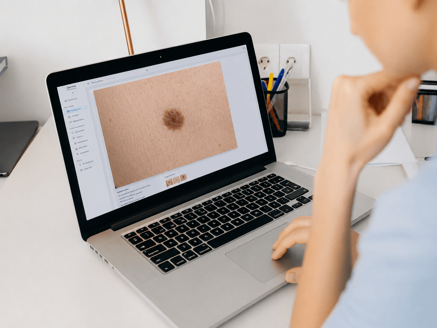 Trečias žingsnis: dermatologas peržiūri atvejį prietaisų skydelyje. Švari sąsajos vizualizacija, vaizduojanti gydytoją arba specialistą, peržiūrintį surinktus paciento vaizdus ir diagnostinius duomenis skaitmeniniame darbalaukio prietaisų skydelyje.